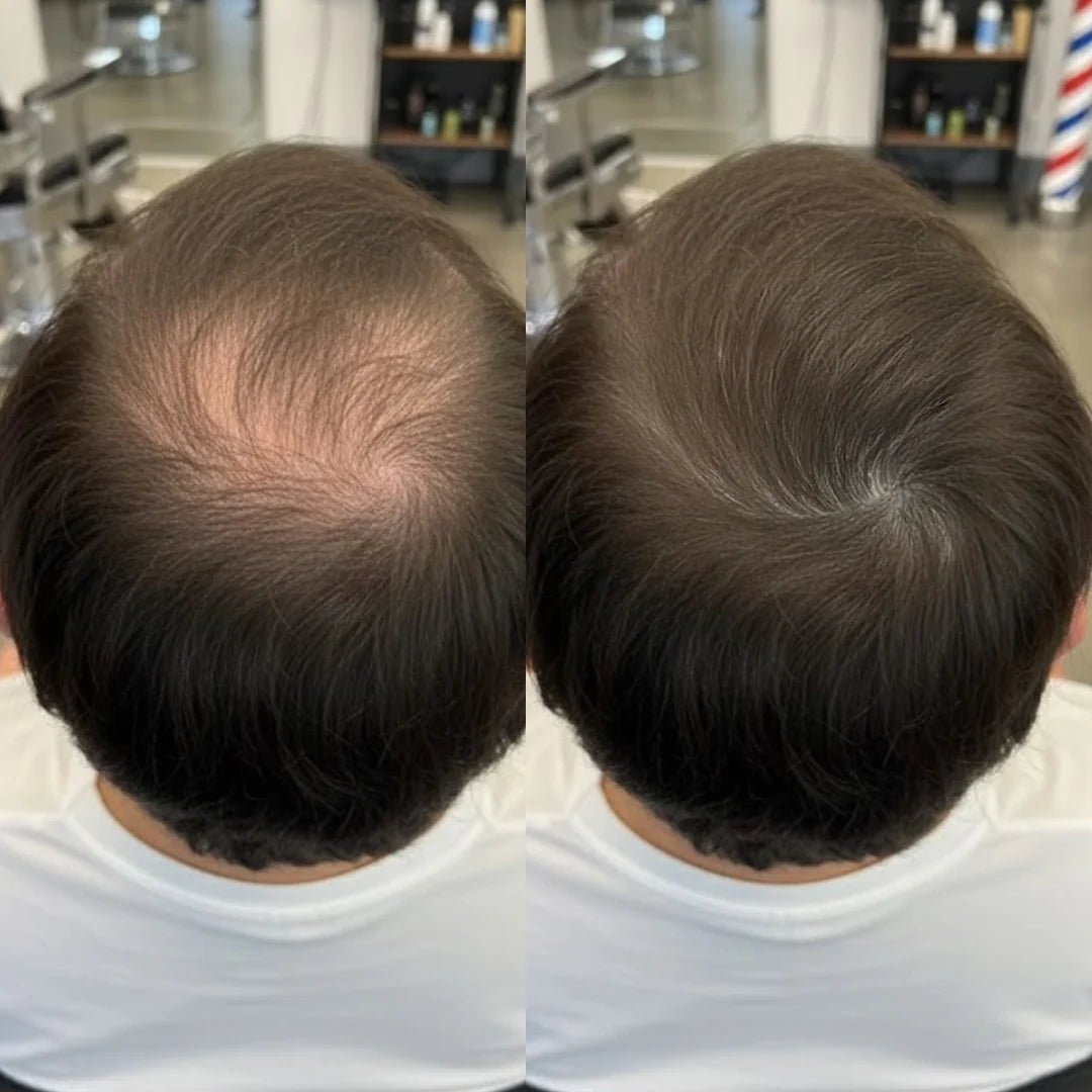 Apex Hair® – Professionell hårkamouflage