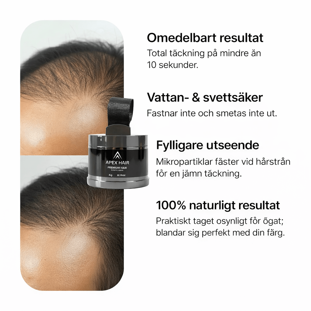 Apex Hair® – Professionell hårkamouflage